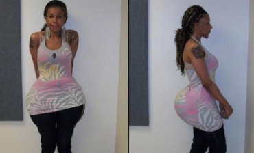 O falso m�dico Oneal Ron Morris, que � transexual, teria aplicado a mistura de cimento, supercola, �leo e selante