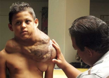 O tumor est� ficando t�o grande que j� afeta a vis�o do garoto.