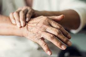 Mal de Parkinson afeta aproximadamente 1% da populao mundial com idade superior a 65 anos  Foto: Divulgao