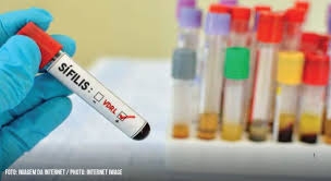 OMS calcula que haja no mundo, anualmente, 5,6 milhes de infeces por sfilis