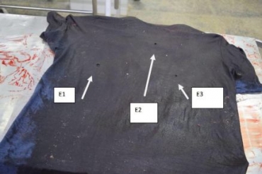 Tiros acertaram as cortar e sa�ram pelo peito da v�tima