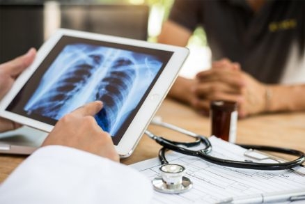 Cncer de pulmo ocupa o terceiro lugar no ranking de incidncia entre o pblico masculino