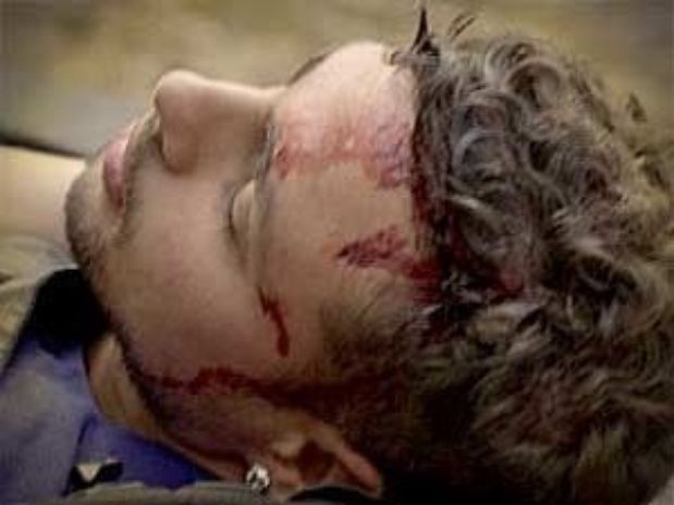 Aps sofrer traumatismo craniano, Jorginho ter que ser transferido para hospital no Rio de Janeiro