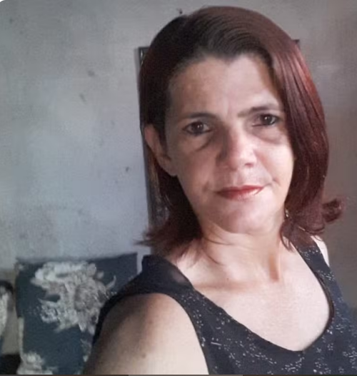 Eliane Cristina Alves Caetano, de 44 anos, tenta obter acesso a uma indenizao no valor de R$ 17 mil aps realizar um procedimento de prteses sobre implantes mal sucedido  Foto: Arquivo pessoal