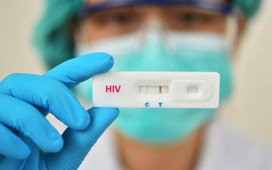 Para realizao da testagem para o HIV, basta ir a qualquer UBS e solicitar o exame. O resultado  fornecido em menos de 30 minutos