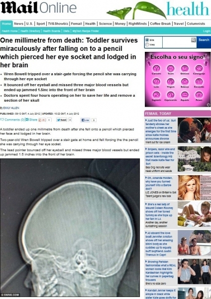 Menina inglesa teve o crnio perfurado por lpis aps tropear em casa