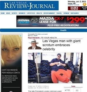 O americano Wesley Warren Jr., que temum caso raro de elefantase