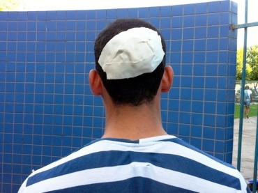 Agente de trnsito levou golpe de marreta na cabea em avenida da capital