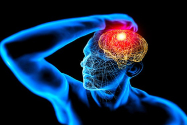 A meningite � uma inflama��o das meninges, membranas que envolvem o c�rebro e a medula espinhal, e pode ser causada por v�rus, bact�rias, fungos ou parasitas