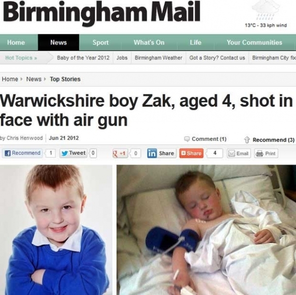 Foto  direia mostra a marca de tiro, entre boca e queixo, que o britnico Zak Horton, 4, levou de uma arma de presso.