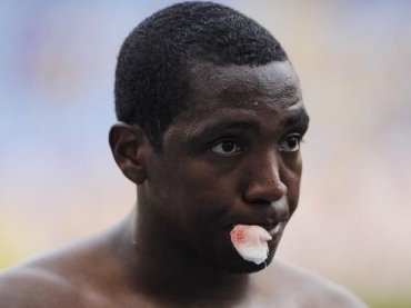 Meia apontou o corte em sua boca como prova de raa na vitria suada do Flamengo