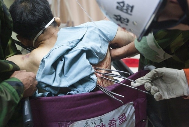 Sete varas de metal se cravaram no tronco do operrio de construo civil chins Zheng