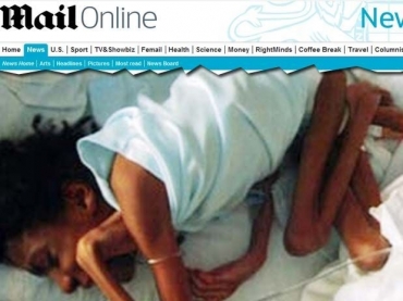 Imagem mostra a menina Darlene Armstrong logo aps ser resgatada de sua famlia pelo servio social