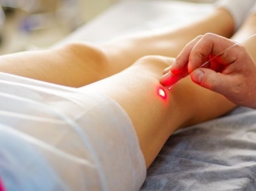 acupuntura feita com laser estimula diretamente as clulas da pele, alm de todos os pontos de energia do corpo que apre
