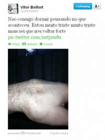 Belfort quebrou a mo e no poder enfrentar Wanderlei