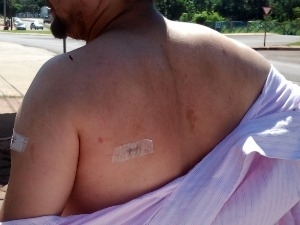 Professor mostra ferimentos causados por aluno.