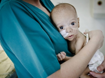 Beb Andrei nasceu sem intestinos e espera por operao. Foto foi tirada em 27 de maro.
