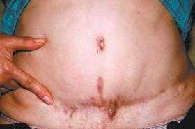 Uma das vtimas do mdico Alexsandro de Souza