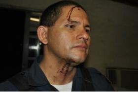 Policial ficou ferido ap�s levar paulada