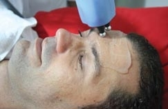O enfermeiro Vagner Dias, de 33 anos, optou pela limpeza facial e a carboxiterapia: sem rugas e sem preconceitos