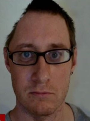 Tim Barter sofreu um acidente h dois anos e precisou retirar parte do crnio