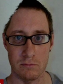 Tim Barter sofreu um acidente h dois anos e precisou retirar parte do crnio