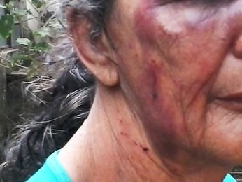 Mulher foi encontrada em resid�ncia com v�rias les�es (Foto: site AGORA MT)