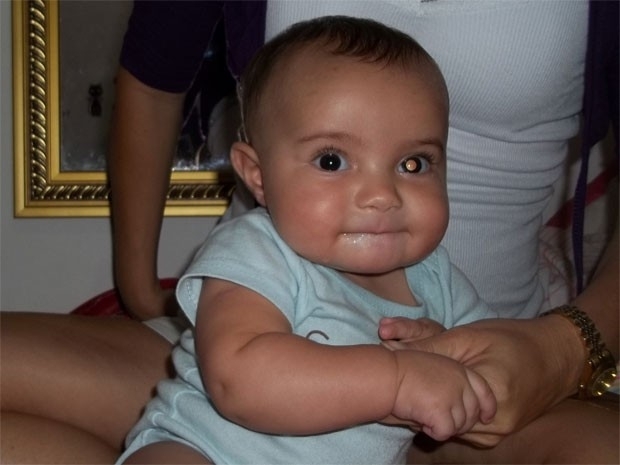 O pequeno Arthur aparecia com um branco no fundo do olho em fotografias, o que levou a famlia a desconfiar de que havia