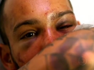 O estudante V�tor Suarez Cunha, de 21 anos, foi espancado e pode ficar com sequelas.