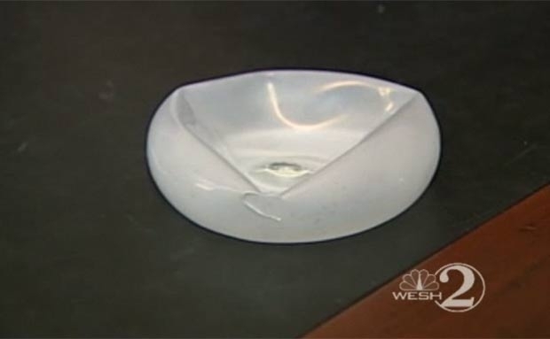 Implante de silicone salvou mulher de ataque nos EUA.