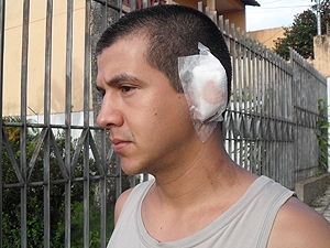 Soldado teve parte da orelha arrancada por advogado.