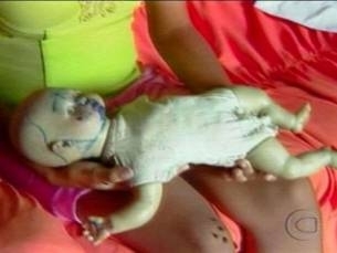 Mdicos do PSMVG constataram que houve violncia sexual contra menina de 5 anos