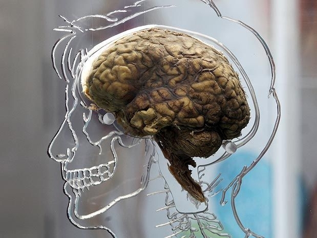 Estudo do c�rebro mostrar� quais tipos de psicoterapia poder�o ativar mais as �reas de satisfa��o