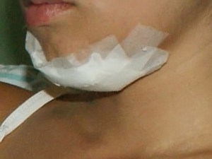 Jovem agredida durante a festa vai passar por cirurgia.