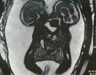 Siameses morrem na manh desta sexta-feira (7).