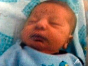 Cau foi desentubado por volta das 12h