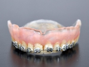 Secretria diz que dentadura estilizada at mudou