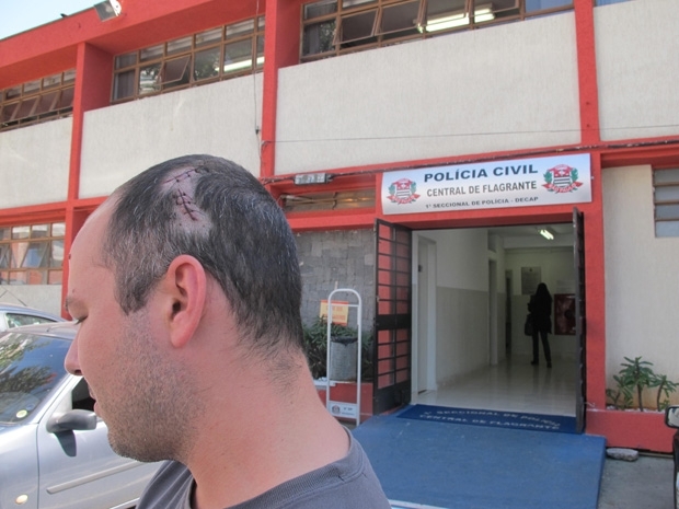 Arquiteto precisou levar sete pontos na cabea aps agresses