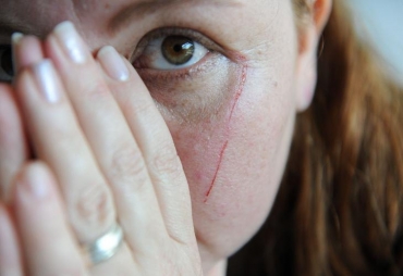 Professora levou socos na cabe�a e chutes pelo corpo