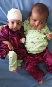 Asree ( esquerda) ao lado de sua irm gmea