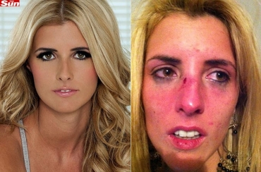 Este , basicamente, um 