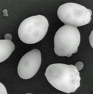 Clulas de Saccharomyces cerevisiae ao microscpio eletrnico