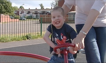 Mason Lewis foi submetido a uma opera��o na qual recebeu um pulm�o de 11 cent�metros