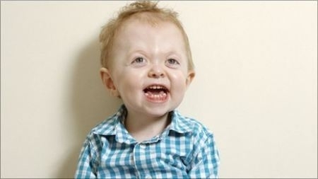 Finley tinha olhos esbugalhados