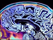 Cientistas afirmam que crebro reage de maneira diferente de acordo com status de outras pessoas