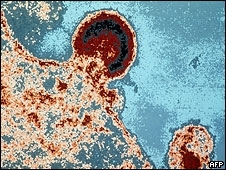 Vrus no foi encontrado em nenhum dos pacientes com sintomas