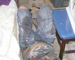 Mulher encontrou o marido ferido  bala no trax quando ia cham-lo para trabalhar. Crime foi na Capital