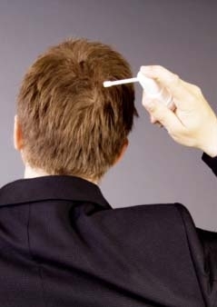 Muitas das teorias relacionadas  queda de cabelo no passam de mitos